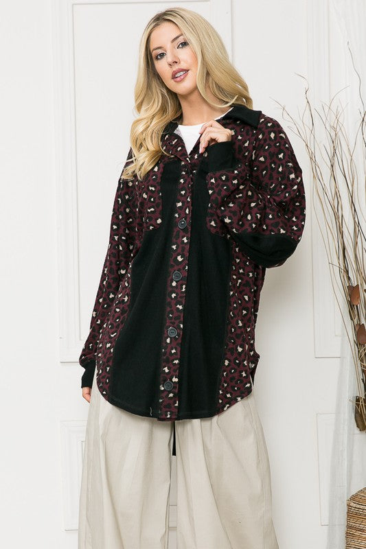 Oversized Elbow Patch Shacket-Charmful Clothing Boutique